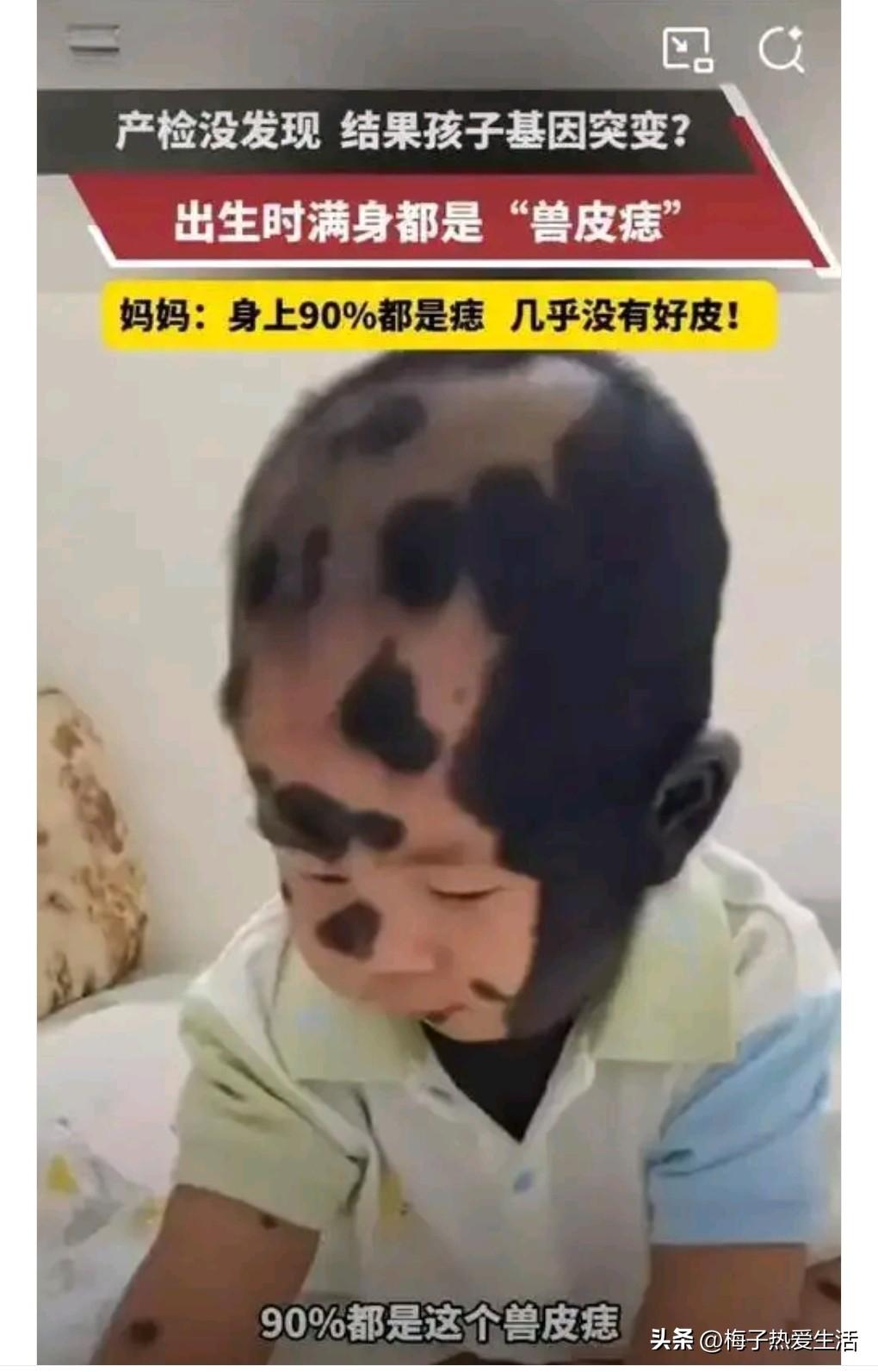 为啥世上有这么多的痛苦，这个家庭怎么能扛得住，大儿子6岁车祸去世，小儿子2岁兽皮