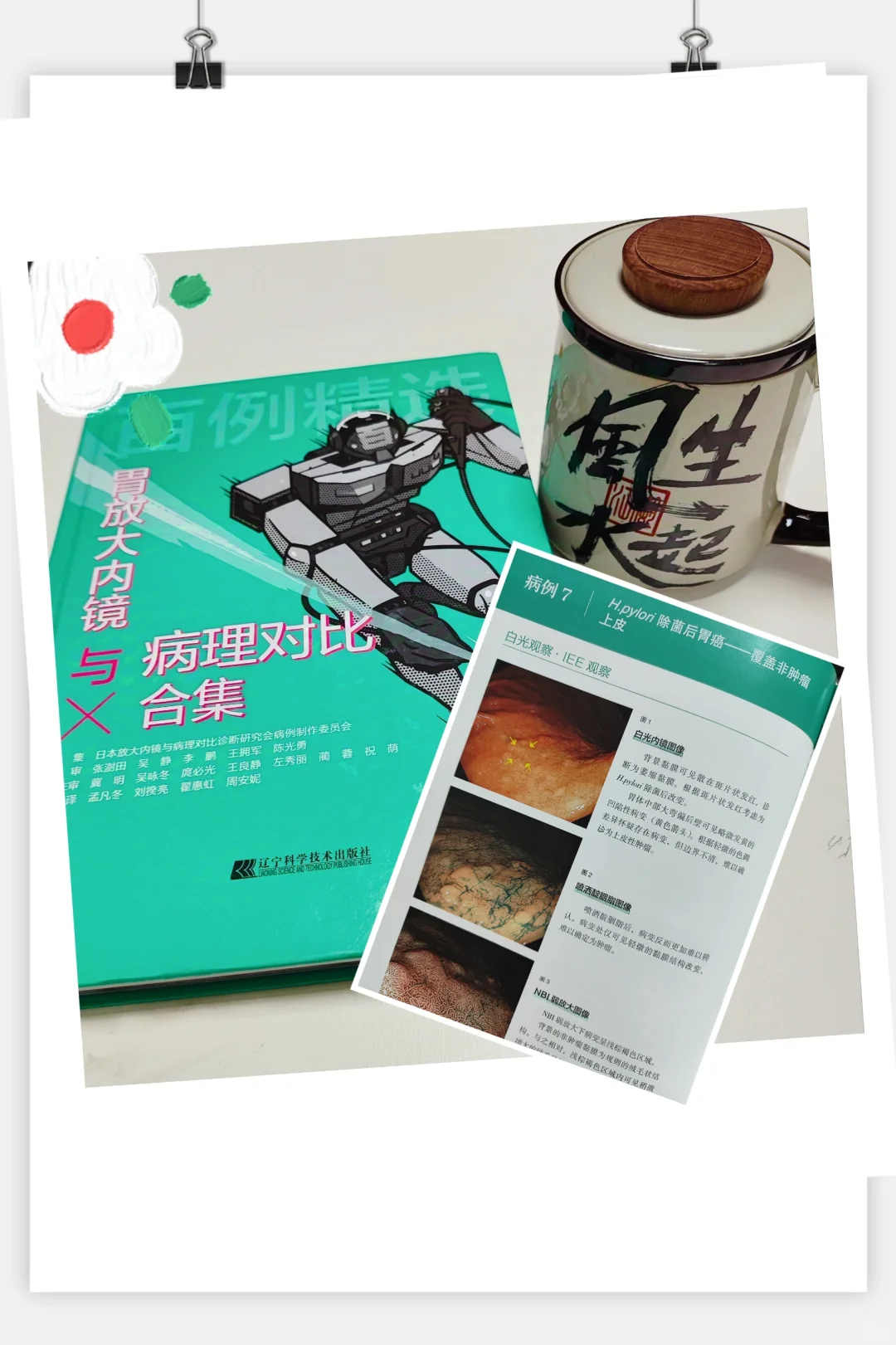 胃肠镜下早期肿瘤诊治的必修书📚之一