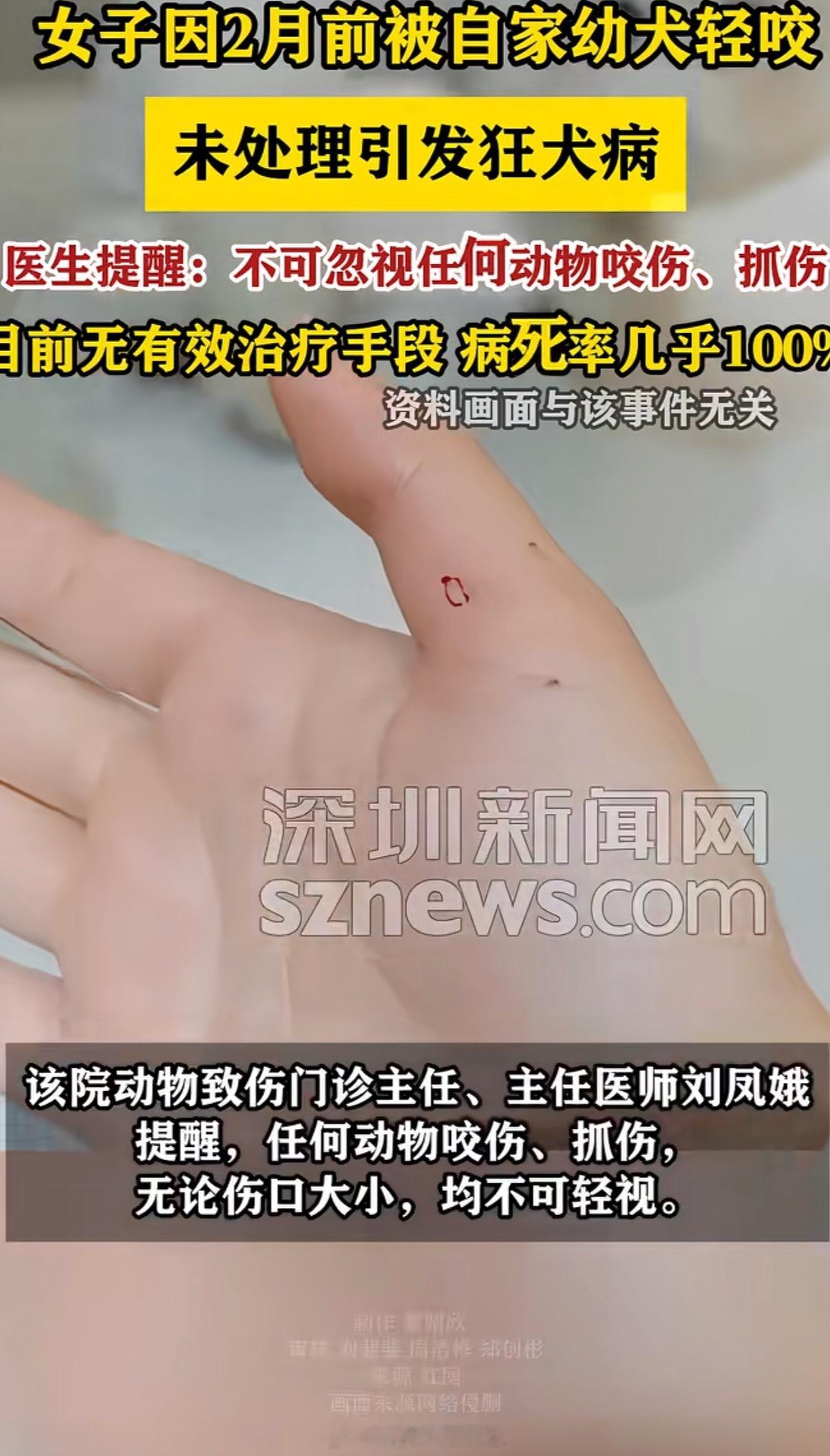 女子因幼犬轻咬未处理引发狂犬病 被咬了，不管狗有没有打针，都建议去打狂犬疫苗， 