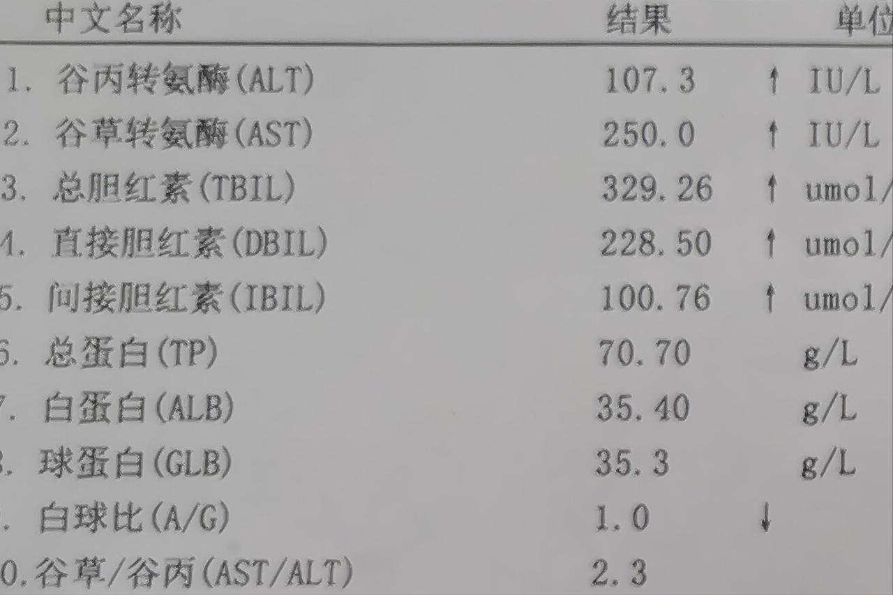 肝功能这两项差值越大，你的肝病越严重！
当转氨酶和胆红素这两项指标的差值变大时，