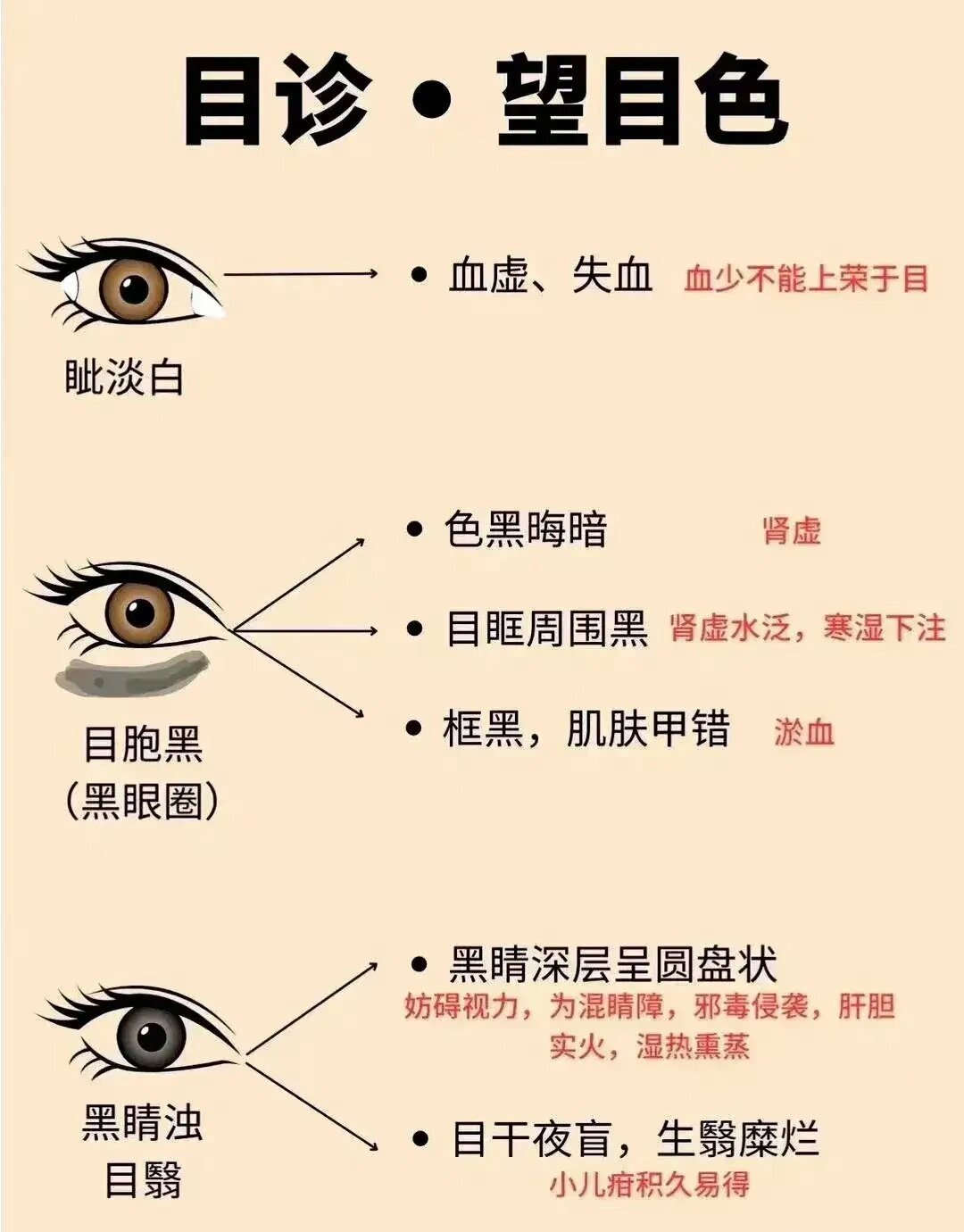 中医目睛五轮歌诀||中医目睛五轮歌诀 ​ ​​​
