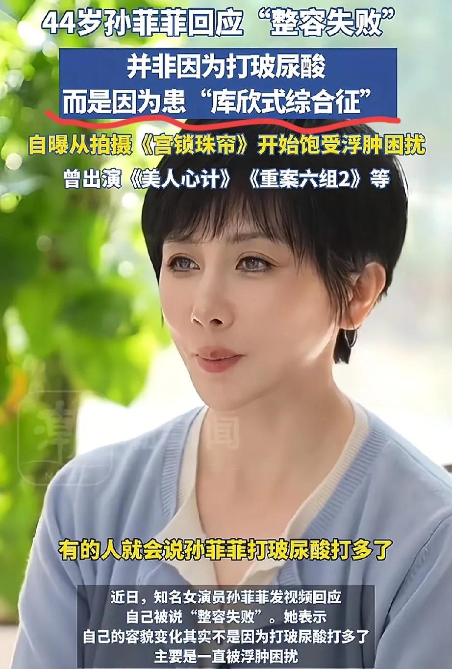 孙菲菲回应自己“整容失败”，辟谣自己没有打玻尿酸打多了。
事实是因为自己拍摄《宫