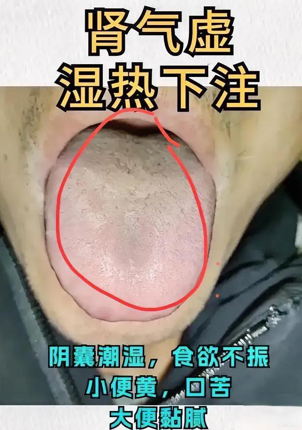 湿在肝、肾、脾？三招祛湿，健脾补肾，疏肝理气！  

湿气黏人，堵哪儿伤哪儿！常