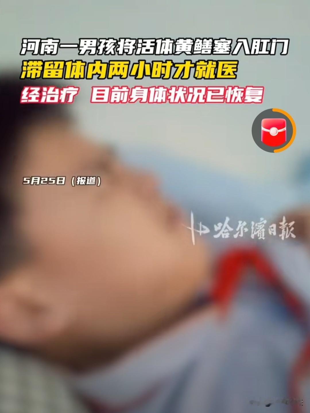 河南商丘，一个14岁男孩为了刺激，把一条活黄鳝塞进l了肛 门内，之后黄鳝就开始往