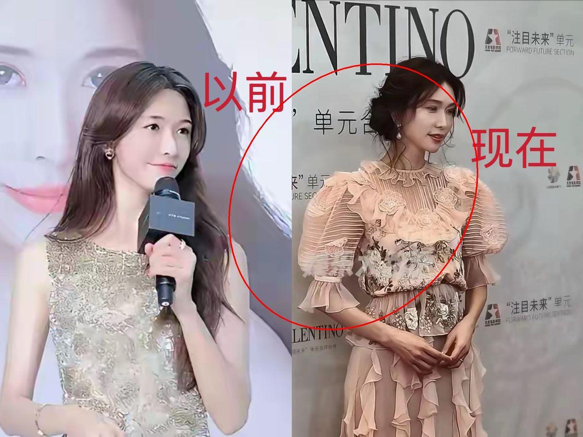 林志玲，实在不行就回来吧🌹
嫁给黑泽良平刚满6年
现在连腰都直不起来了
走路双