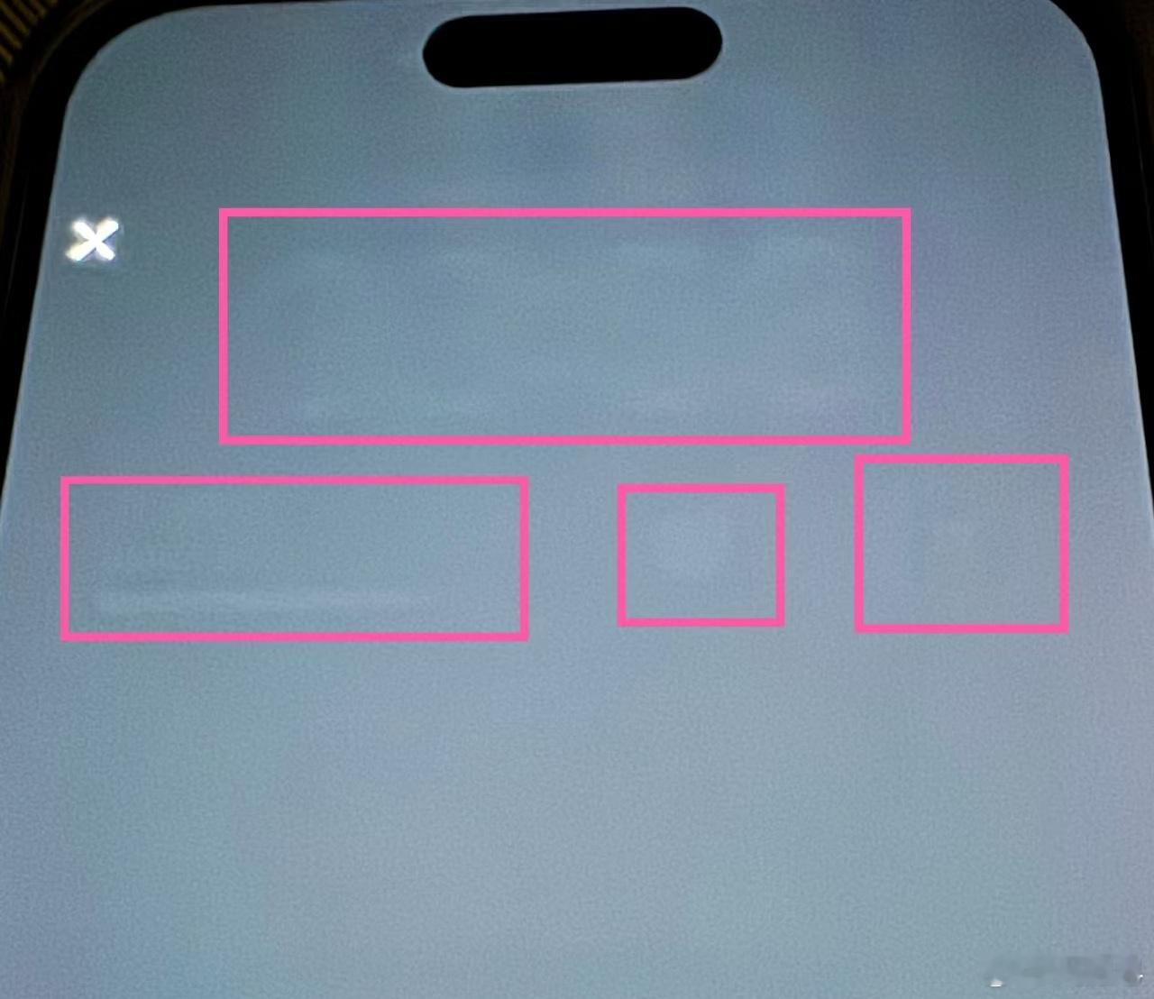 女生同个视频播6小时后手机留下水印  这就是手机屏幕烧屏了，毕竟现在手机基本都是