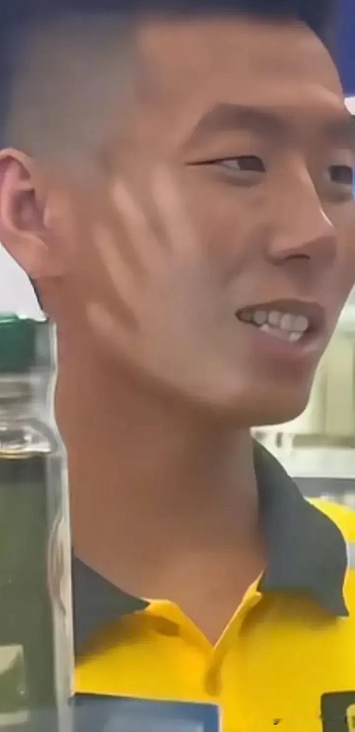 外卖小哥脸上一边一个巴掌印，他自己浑然不觉，还走街串巷的送外卖。一连几个客户问他