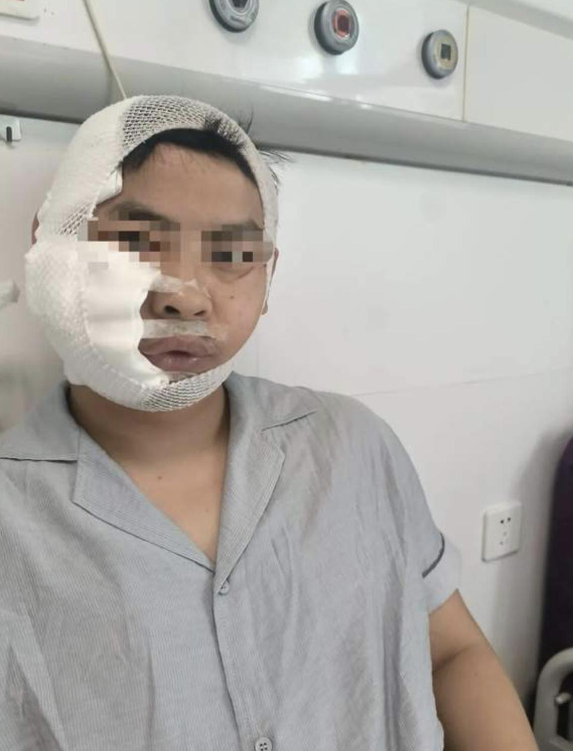 男子花480元潜水被鲨鱼咬9处，这哪是潜水体验，简直是“鲨口逃生”真人秀！下水不