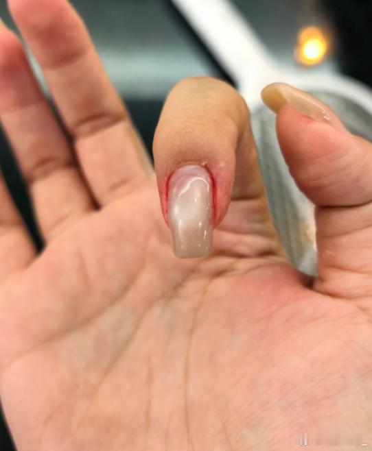 女子做美甲后手指触地摔骨折 平时就粗心大意的人，最好还是别做太长指甲，很容易掀开