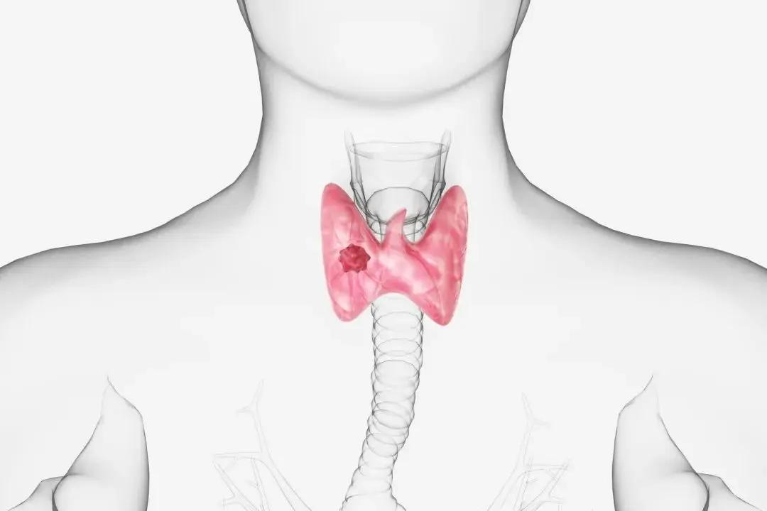 中年人每天减少约14%热量摄入，不用极端节食，只要做到每顿少吃两口，长期坚持就能