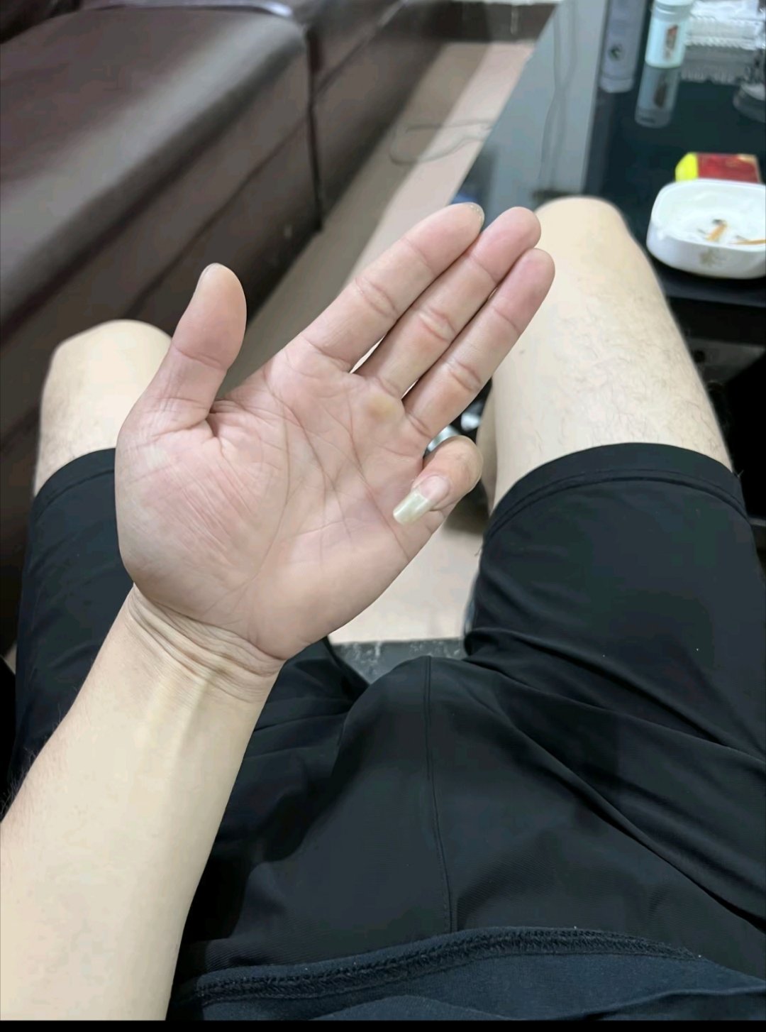 为什么会有这么长的小指甲 