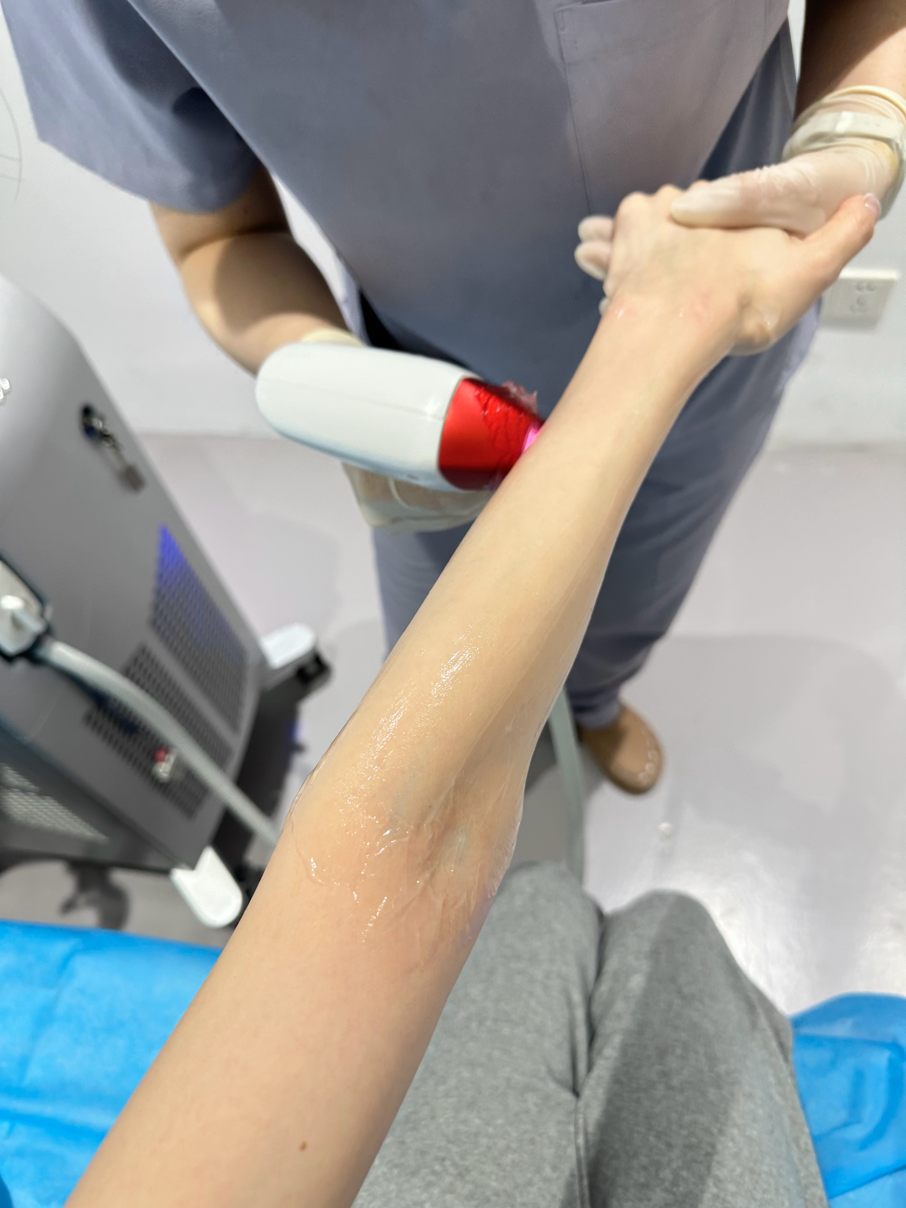 女人 在变美这块绝对不会有拖延症昨天发现颈纹了 今天就安排上💉顺便脱毛牛奶光一