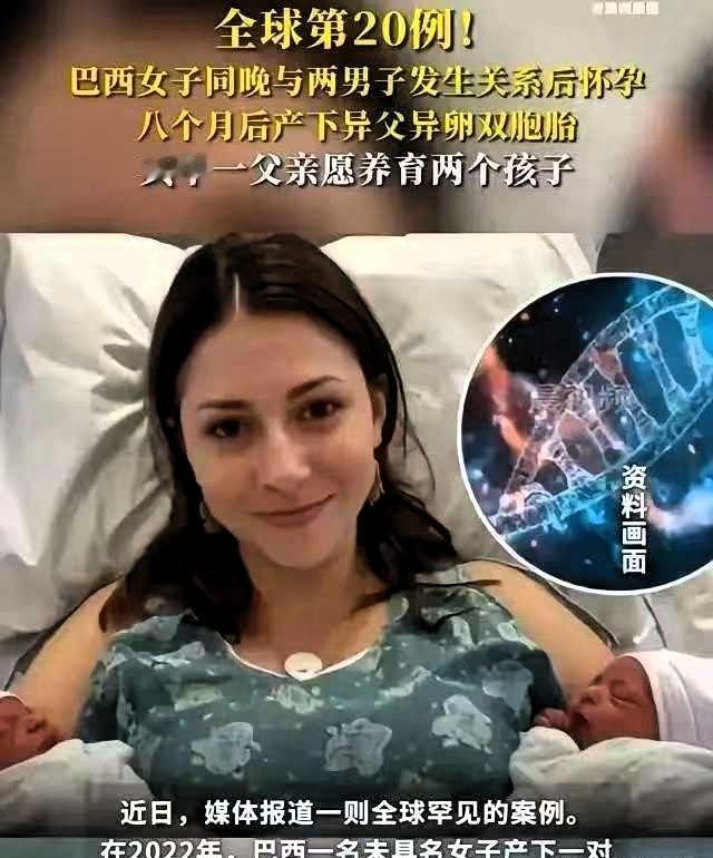 全球仅20例！巴西女子同一晚与2名男子发生了关系。不久后，女子后怀孕了，并且还生