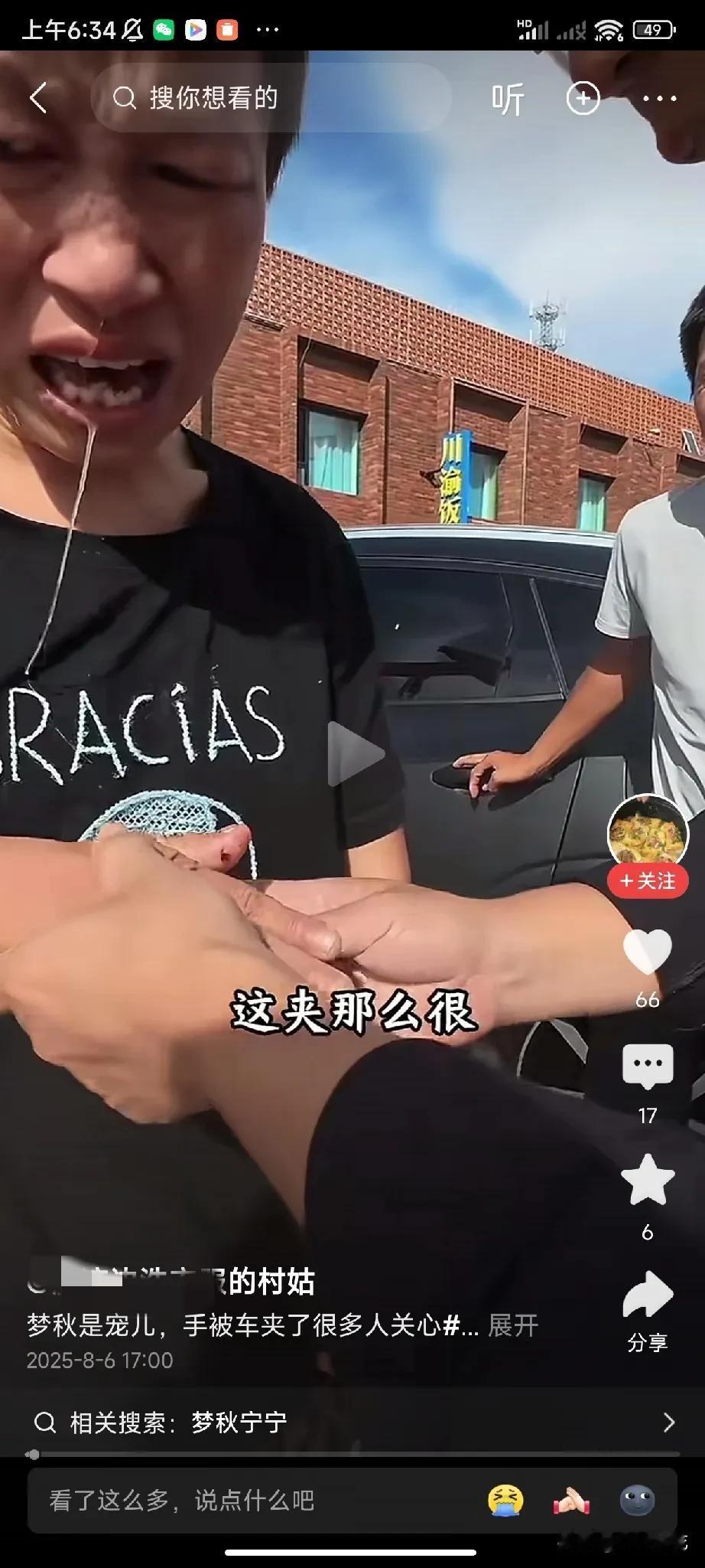 傻梦秋被车门夹到了手，哭得哈喇子流一身，亮哥又是摸手又是哄，即便这样，也没忘了拍