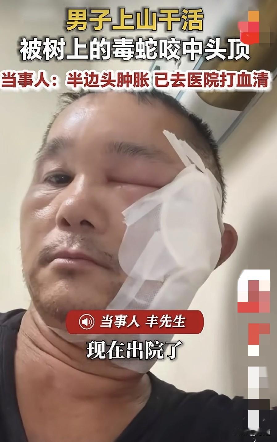 真是让人哭笑不得。
近日，广西百色的丰先生去地里干活儿时，路过一棵树，这棵树不高