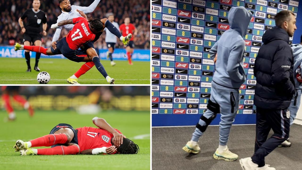 马杜埃凯在友谊赛中被对方撞倒并被换下，他左膝戴着护具离开温布利球场。
现场所有记