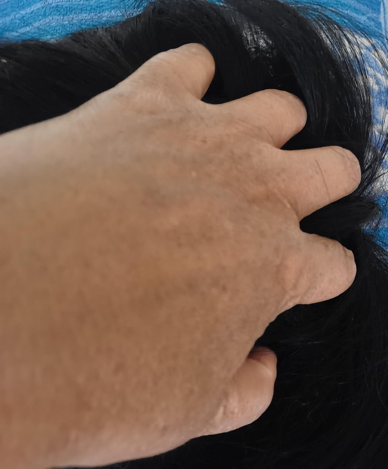 每天早晨用手梳头30分钟能预防脑梗？
从原理上看，用手梳头能促进头部血液循环，就