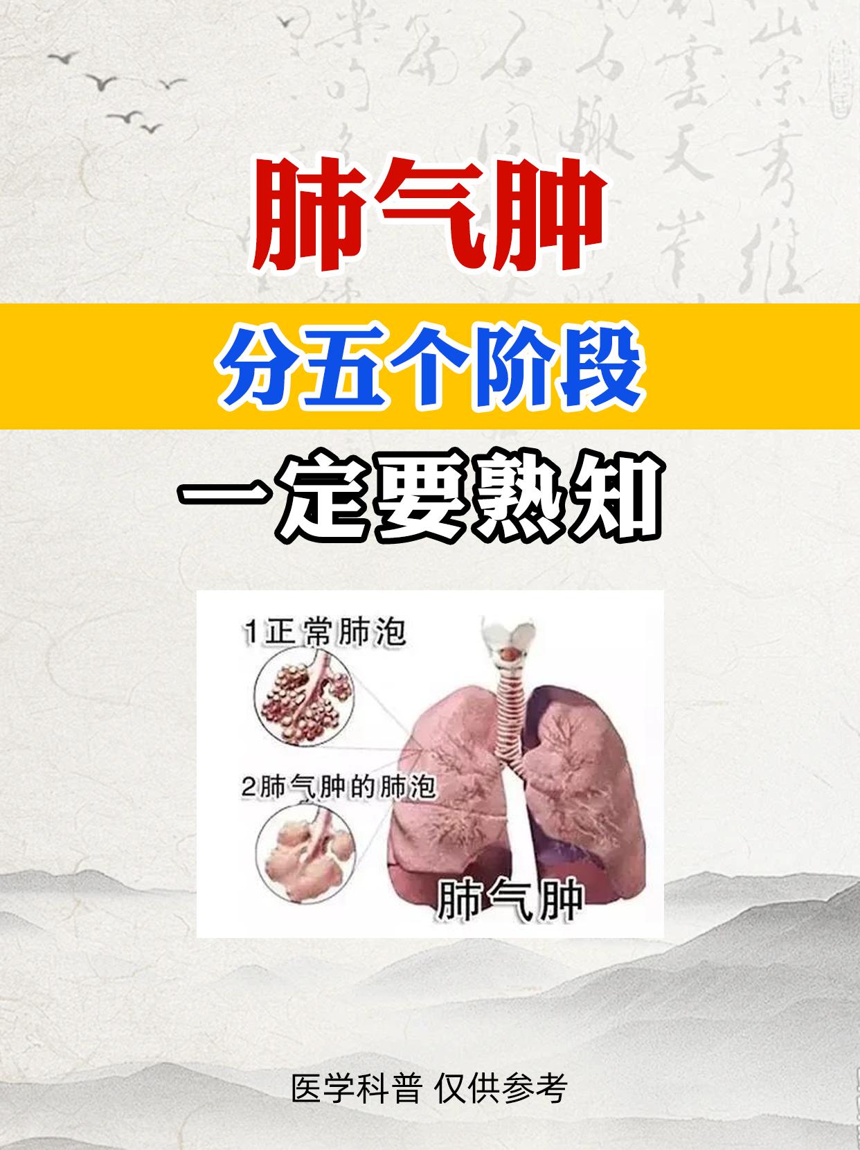 肺气肿 咳嗽 肺部健康
