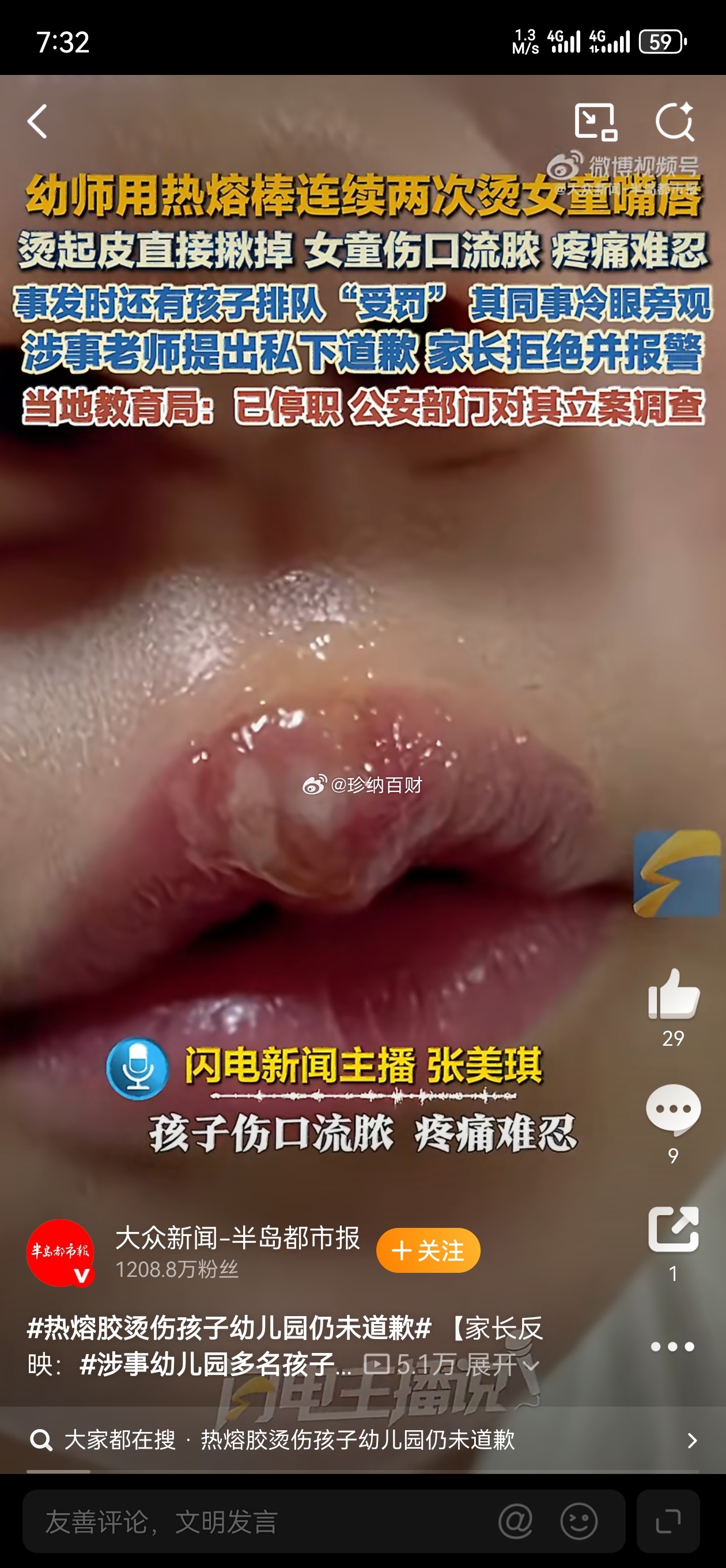 多名幼儿园小朋友被老师用热熔胶烫伤我的天，这个事我觉得特别特别恶劣的一点是，那个