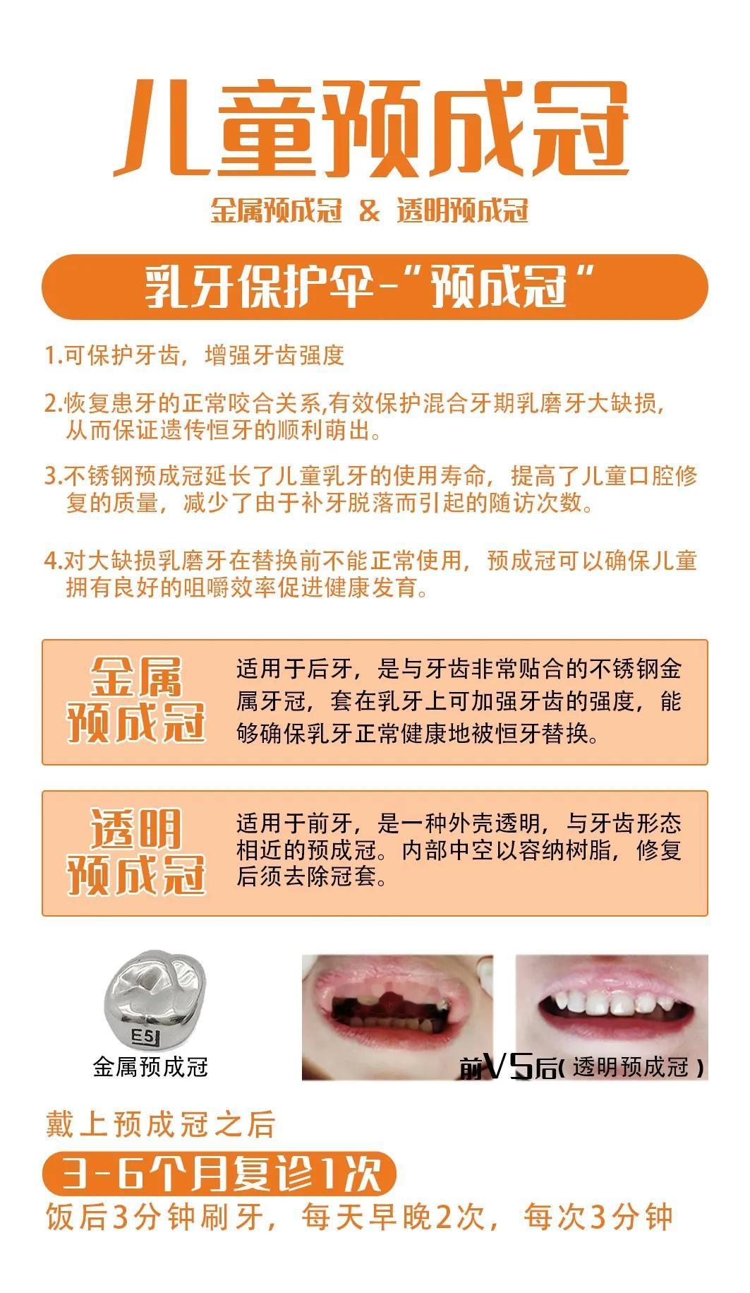 儿童预成冠是干什么用的，看看就知道了