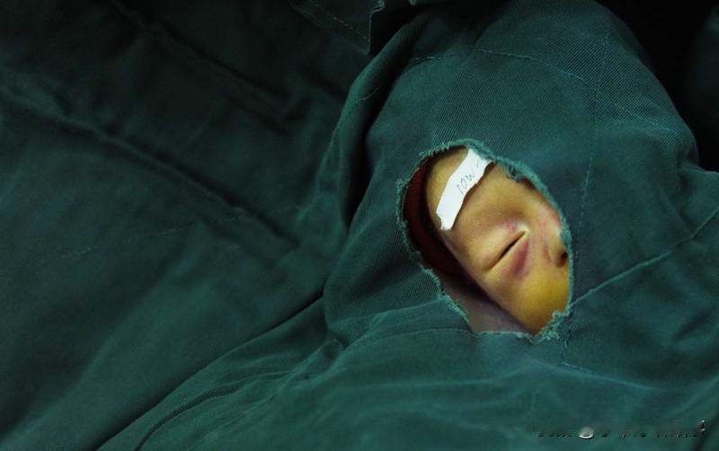 当下，医疗行业的商业贿赂问题令人忧心。有大学生近视手术失败，称河北邯郸爱眼医院涉