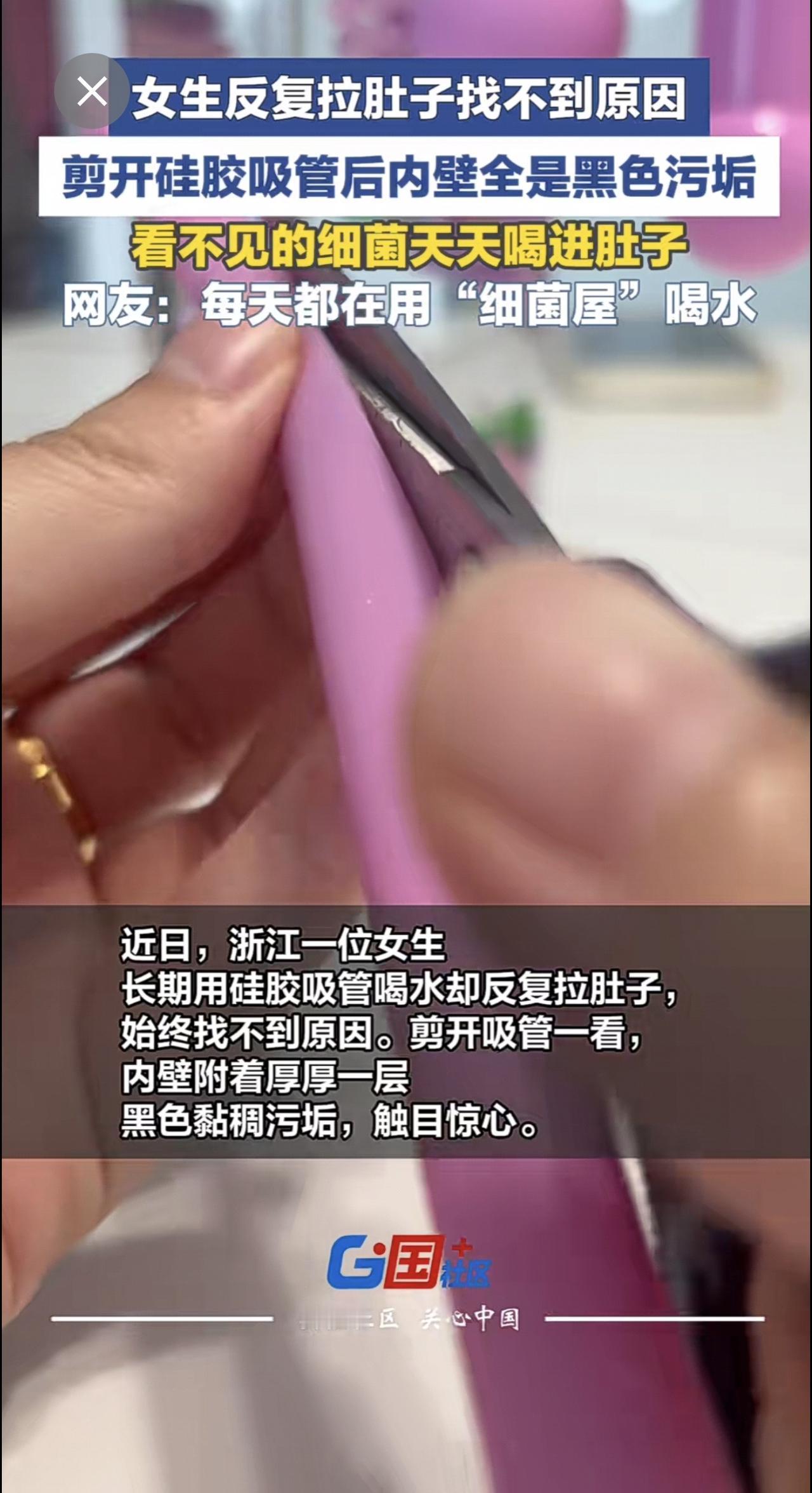 浙江女生反复腹泻元凶竟是硅胶吸管，剪开后内壁附着厚厚黑色黏稠物。医生提醒：吸管杯
