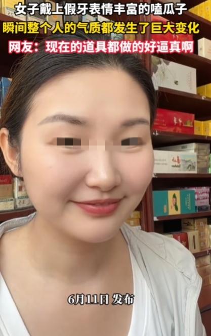 我说最近网上怎么这么多龅牙的呢？原来还有道具，而且做的好逼真啊！

前一秒还是小
