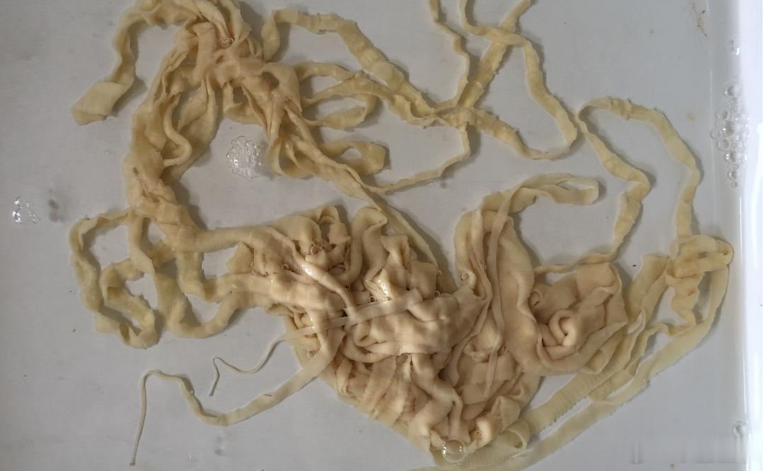 不要生吃或半生吃猪肉牛肉牛带绦虫病是由寄生于人体肠道中的牛带绦虫所引起的一种寄生