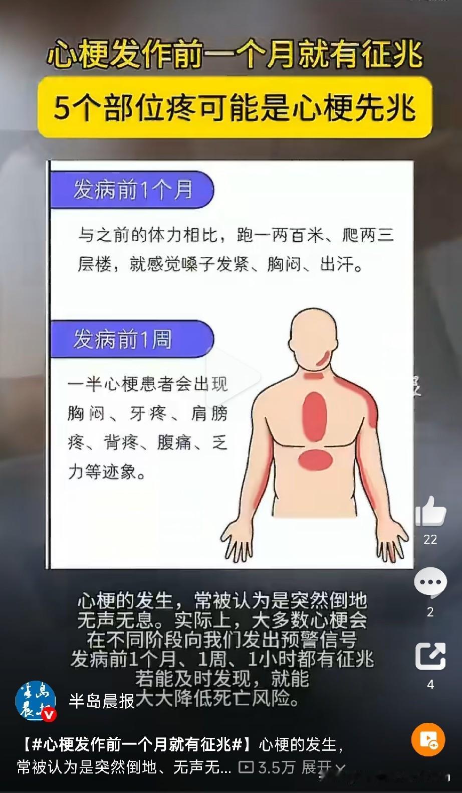 医生反复提醒，心梗在发作前一个月、前一周、甚至发作前短短一小时，都会发出不同的预