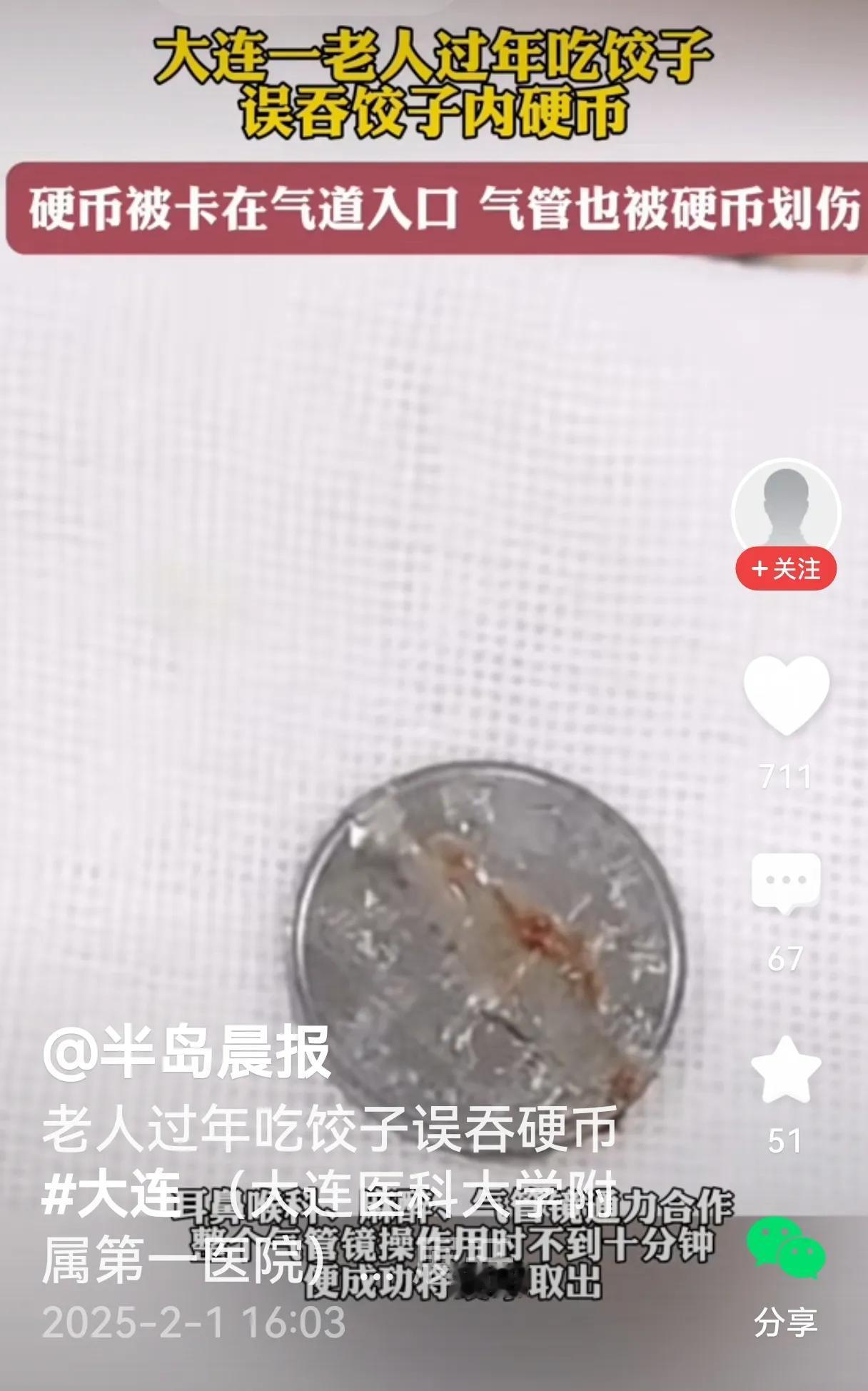 小孩和老人很容易出现这样的事情，每年过年几乎都有这样的新闻。中国人过春节包饺子习