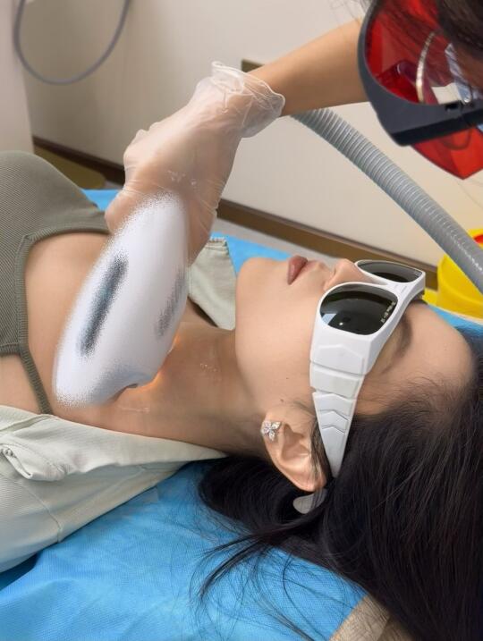 🕶️夏日肌肤大作战🌞见招拆招完美逆袭❗
