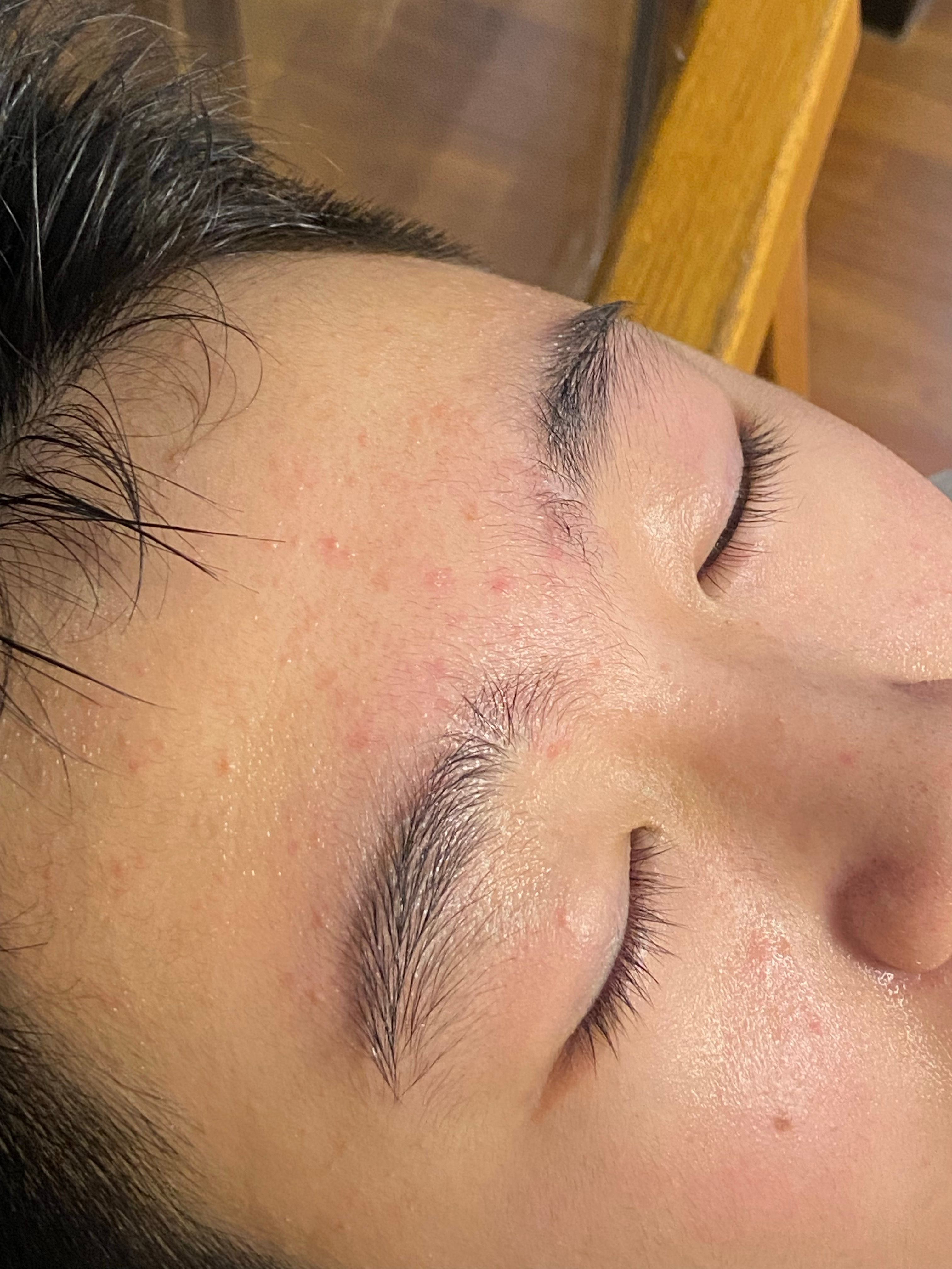 一则护肤记录图1和图2是昨天晚上11点图3是今早 感觉有点作用！看起来好一点了这