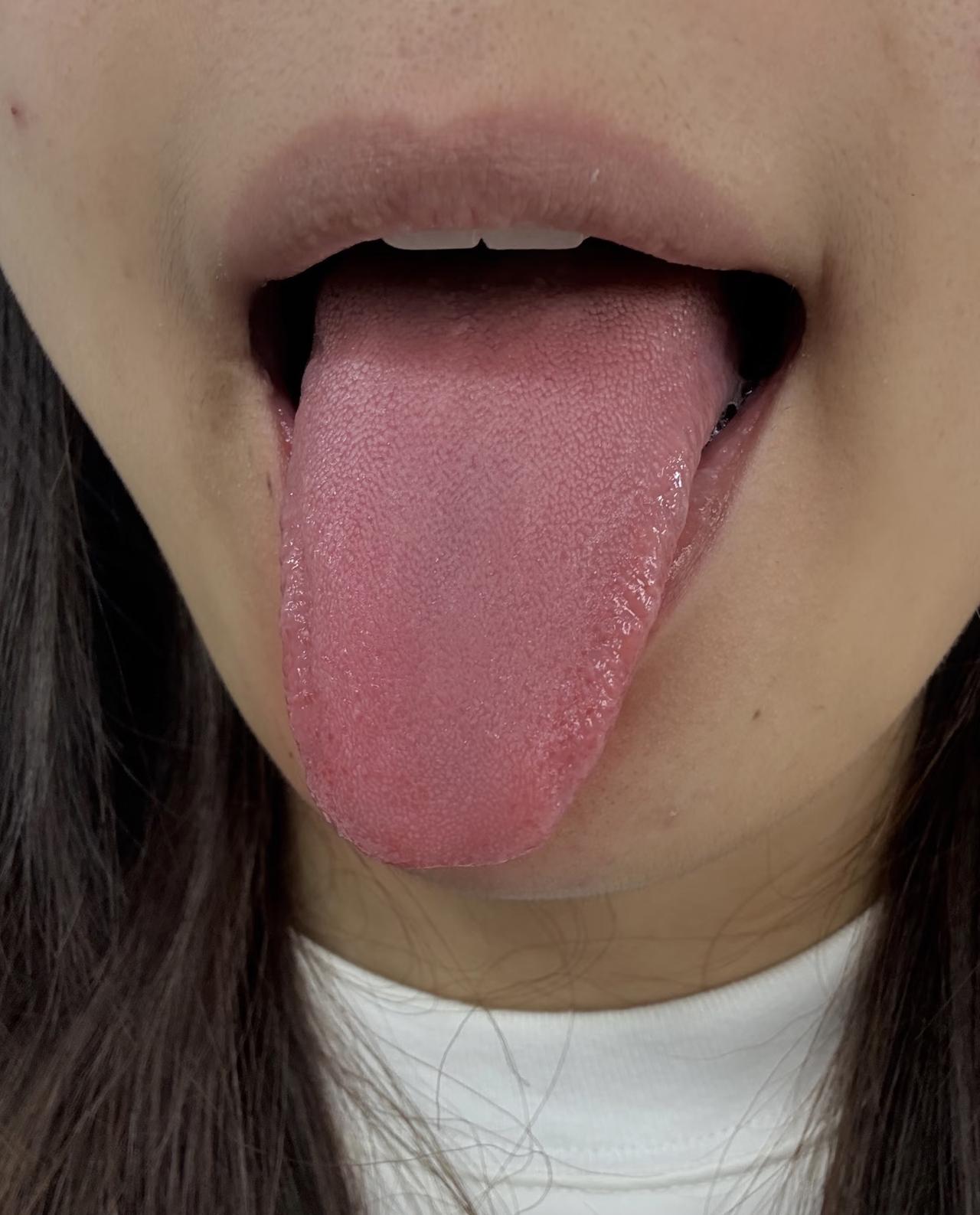 脾胃一虚，百病自来！这6个信号提示你湿气太重，最后一个几乎人人中招！

✅ 黑眼