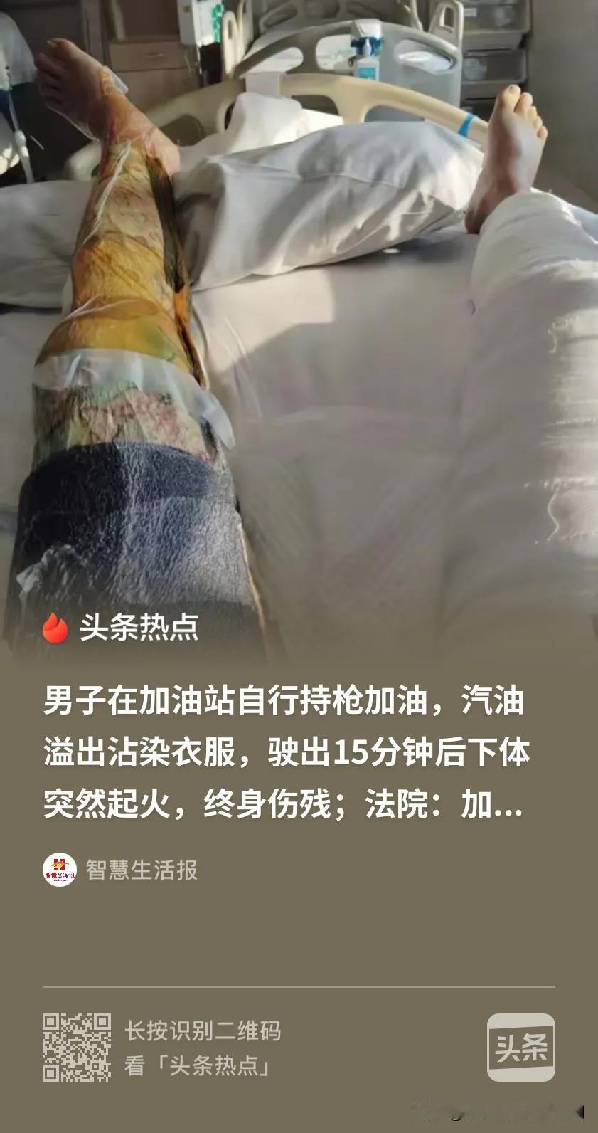谁也没想到，一次偷懒的私自操作，竟让一名普通车主付出了终身残疾的惨痛代价！
 
