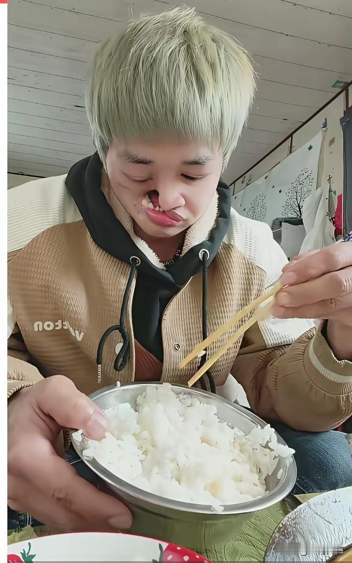 这个小伙得的这个毛病，在小时候没有得到及时的救治，如果得到及时救治的话，不可能是