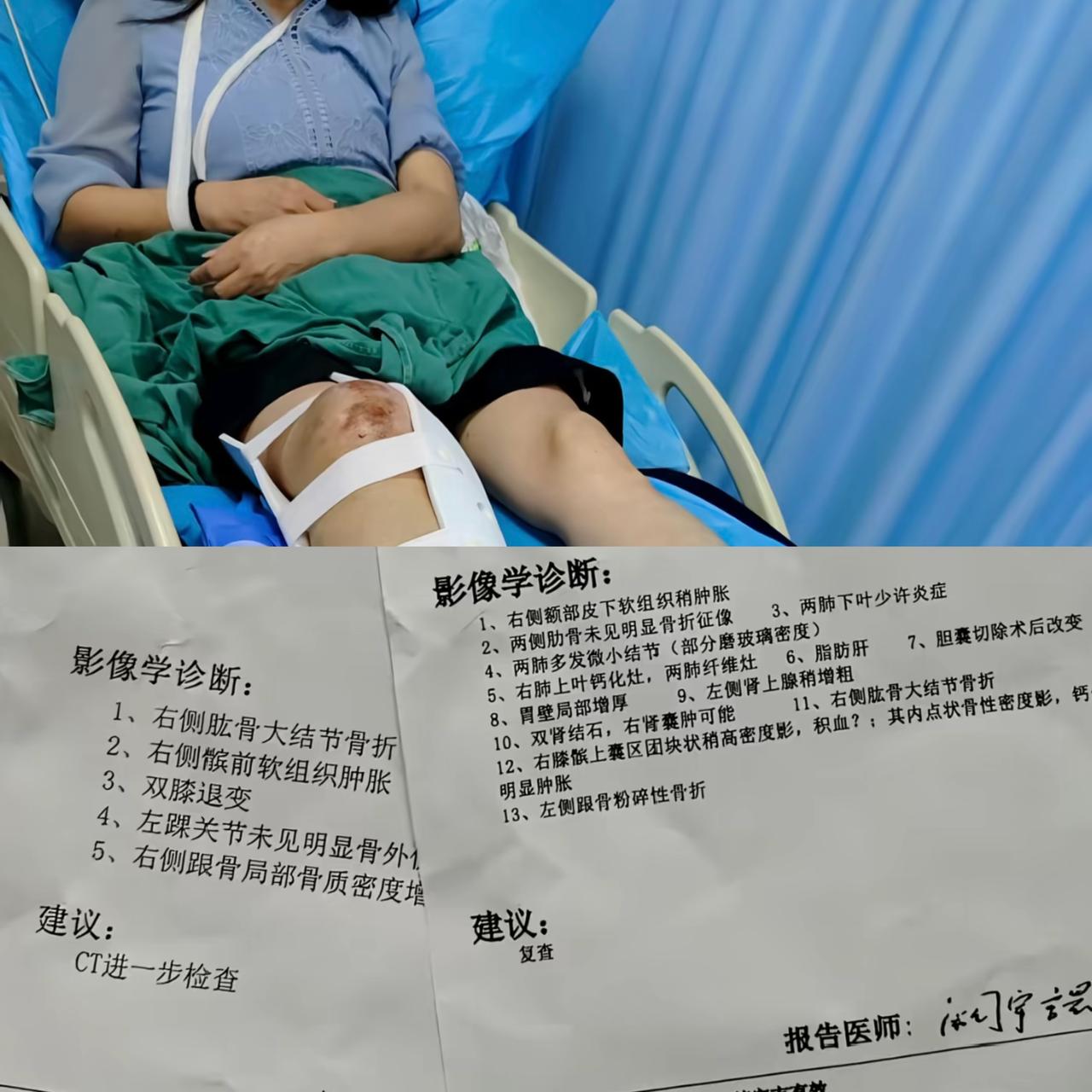 无锡高铁站站台上掉下去个女乘客（安全获救），原因是被列车灯光晃到产生错觉，紧接着