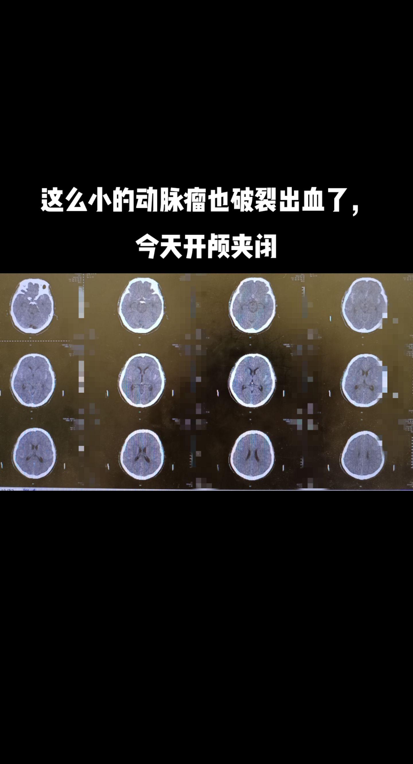 医生日常 医路有你 医学科普