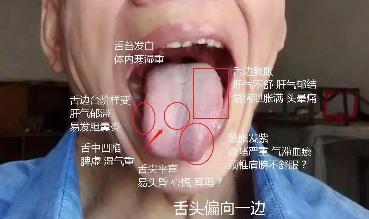 今日线上看诊 看看你的舌苔是哪种