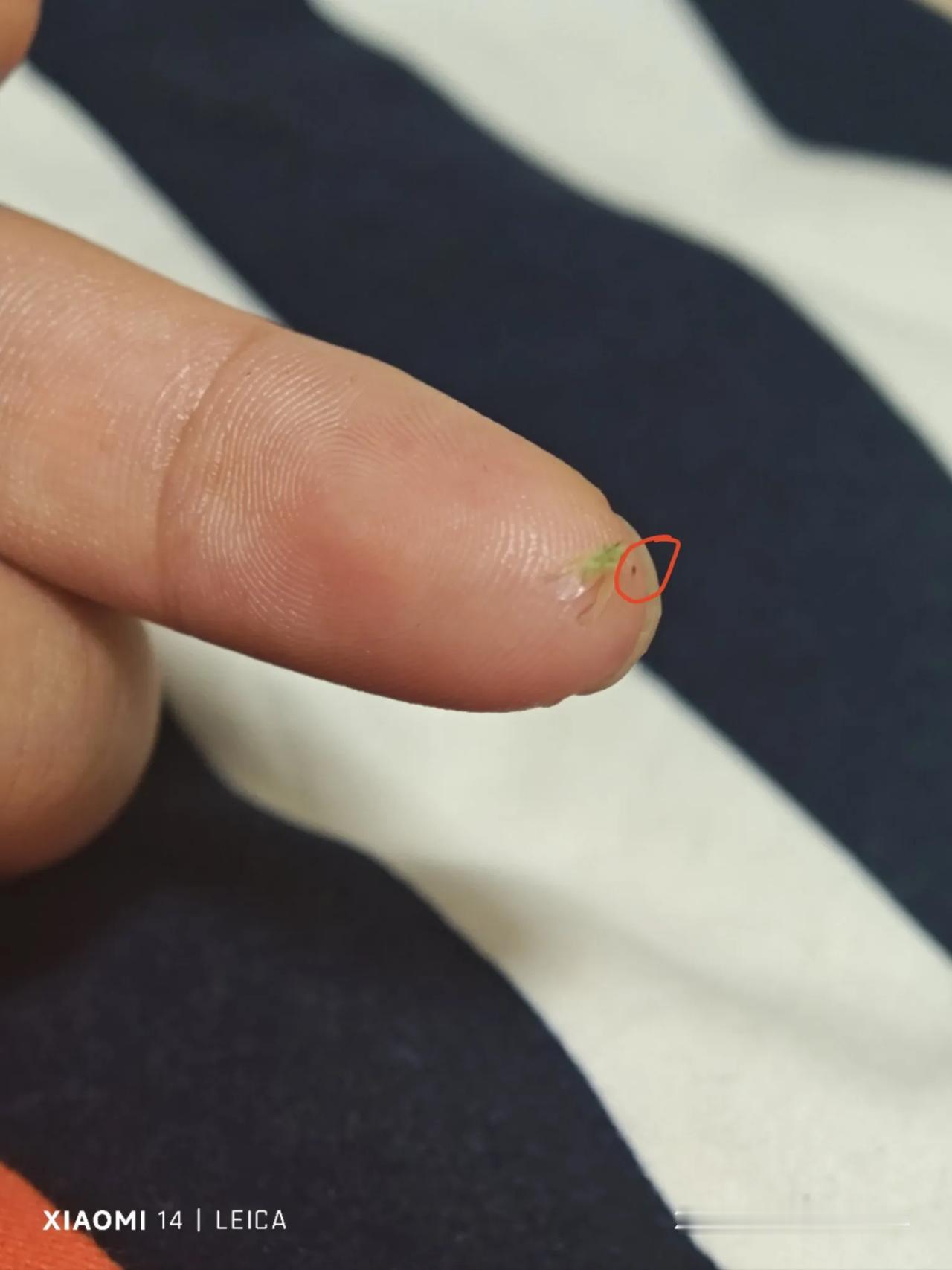 
今天打死了一只虫子，他在吸我血，上网搜了一下，这个叫绿色飞虱，友友们有见过吗
