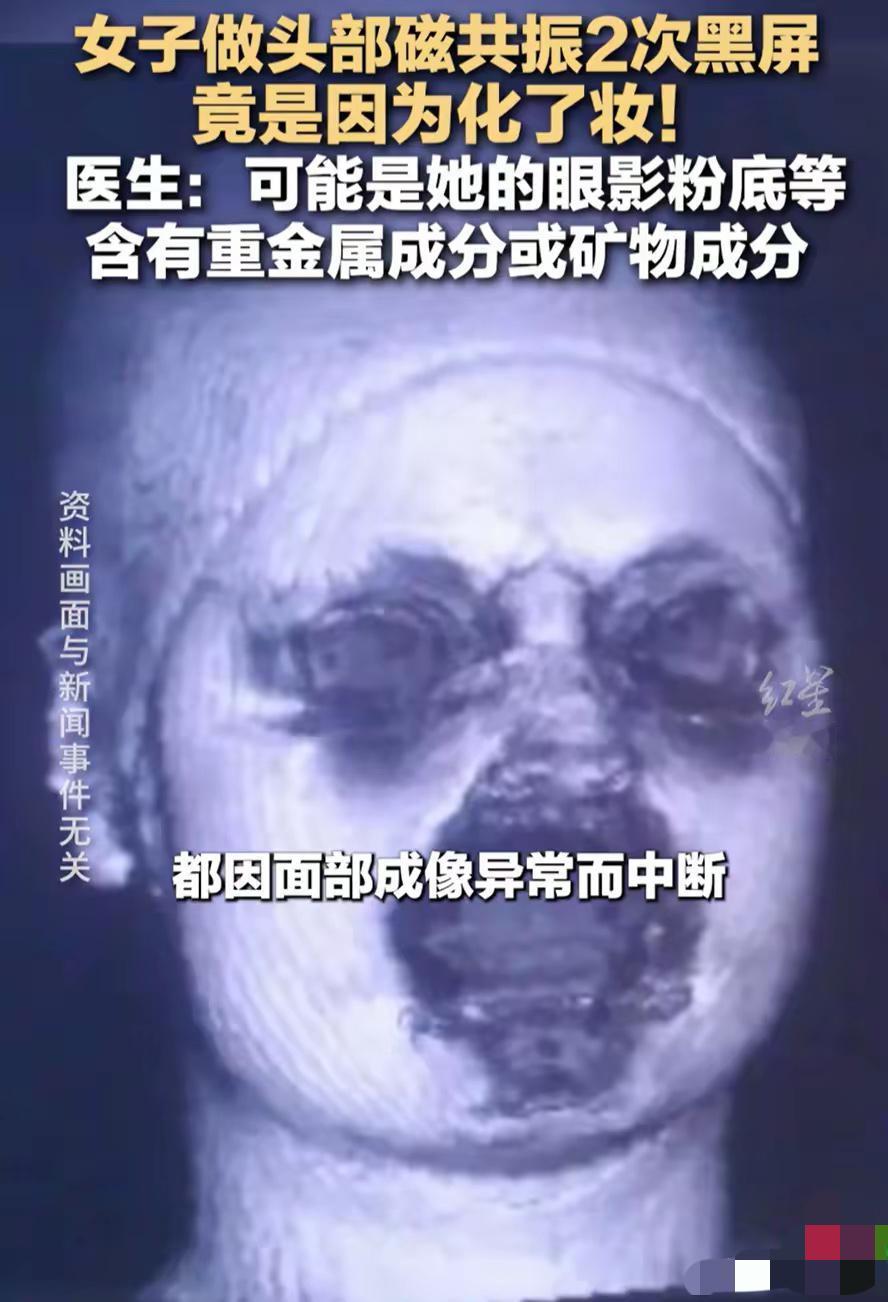 谁能想到，每天涂的淡妆居然能让医院的磁共振直接“罢工”？

福建29岁姑娘头晕做