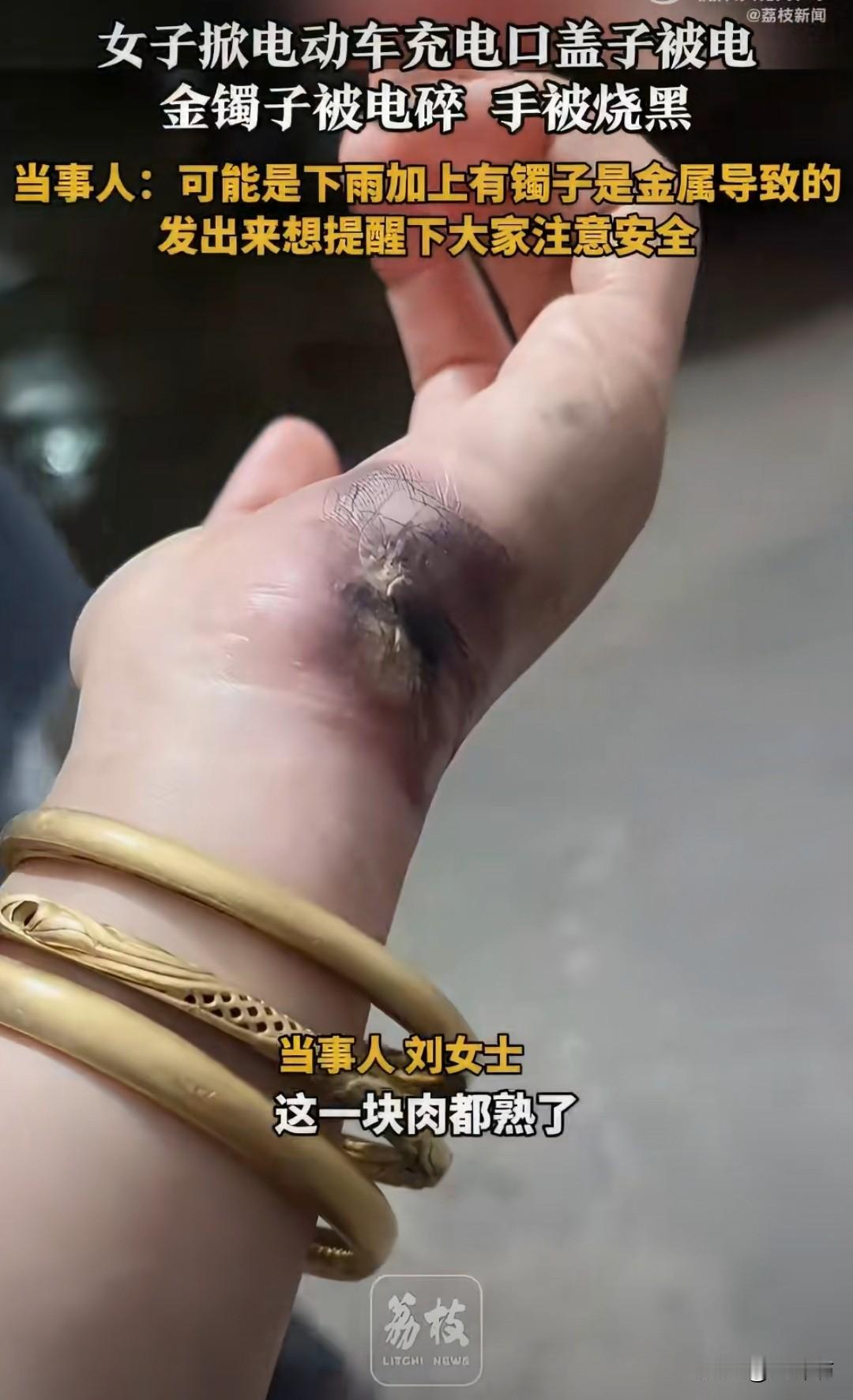 女子给电动车充电时，手上的肉被电熟了，充电器也被电融化，据说连金镯子也被电碎了。