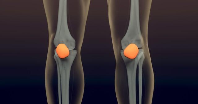 膝关节骨性关节炎就像个调皮的“小怪兽”，已经成了我国60岁以上人群的常见病，超过