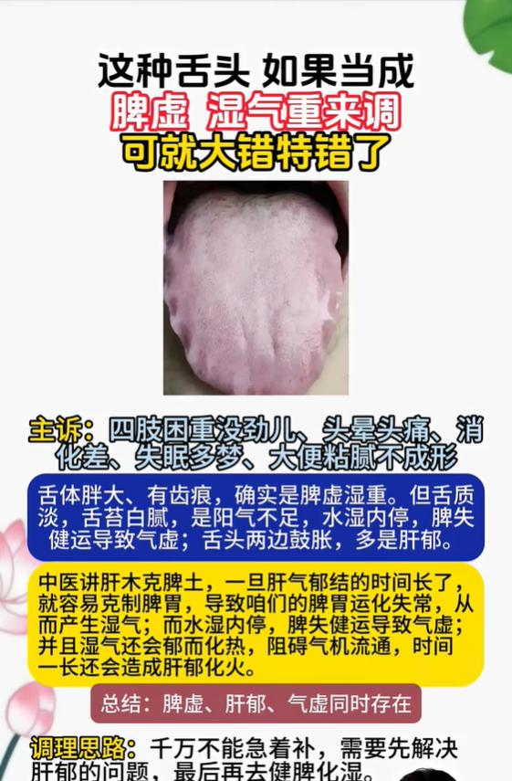 舌体胖大有齿痕别单纯祛湿，肝郁脾虚气虚复合舌象辨证调理