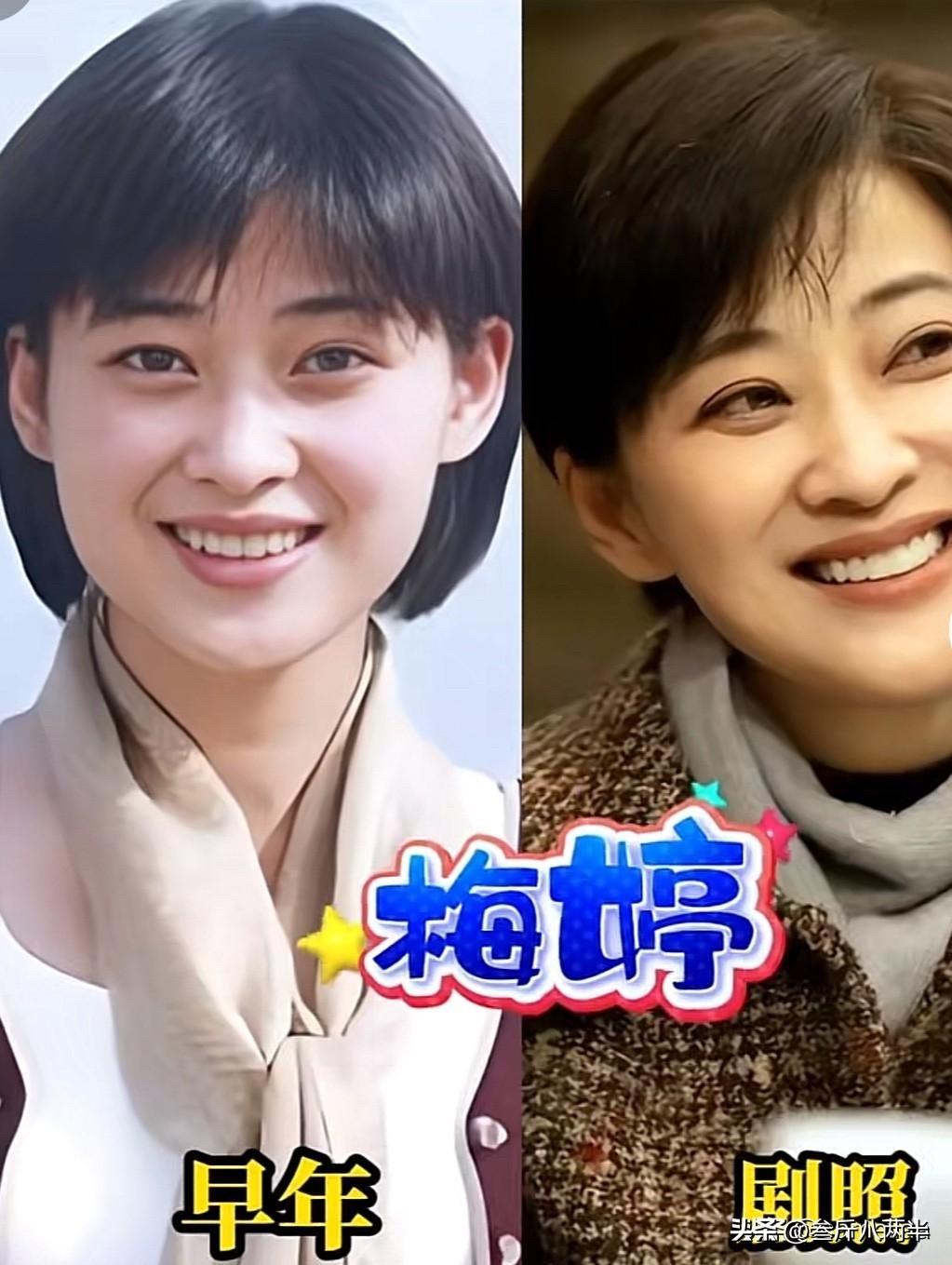 《好好的时光》这11位演员，年轻时跟现在比，变化也太大咧！

梅婷——从小就好看