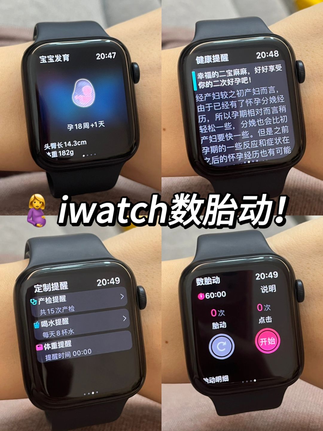 iwatch数胎动！孕期神器！