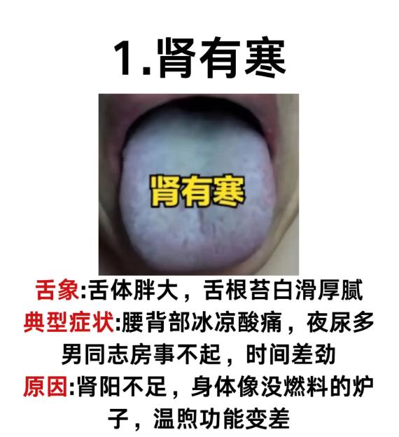 五脏寒不寒，看舌象就知道！5 种典型寒证舌象