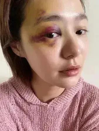 #老公对我动手该不该原谅#不该原谅，你总要为自己的行为买单，有时候心软是病，得治