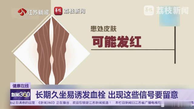 【#小伙久坐玩游戏确诊下肢血栓# #每坐1小时起身5分钟防血栓#】近日，浙江一位高考考生长期久坐玩手