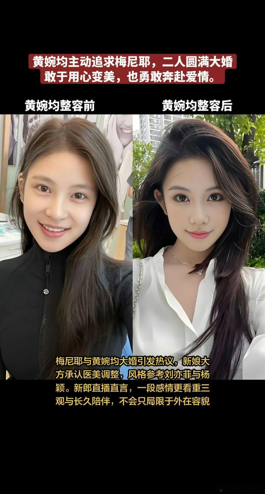 梅尼耶老婆整容前后对比梅尼耶老婆黄婉均整容前后对比 梅尼耶老婆黄婉均整容前后对比