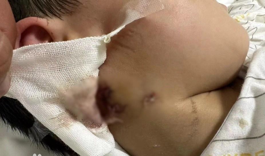 这狗还能留吗？恶犬伤人有明文规定，这狗必须除之，狗主人也得接收处罚。